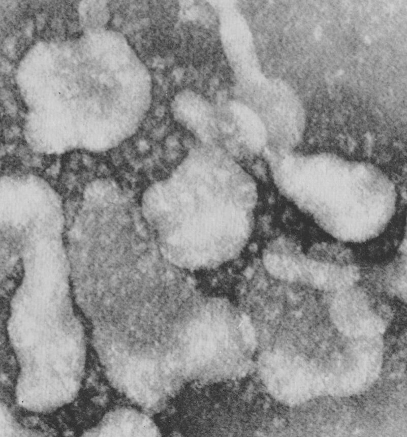 Poznaj wirusologa, który odkrył pierwszego ludzkiego koronawirusa